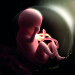 Foetus